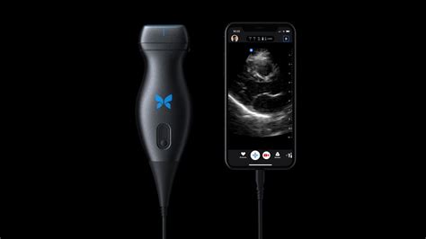 Ultrasound butterfly. Things To Know About Ultrasound butterfly. 